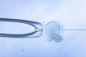 IVF Clinic in Trichy Best Fertility & IVF Treatment Center 4 IVF clinic in Trichy
